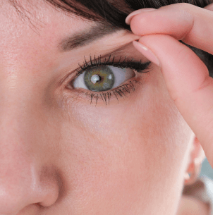 Blepharoplasty