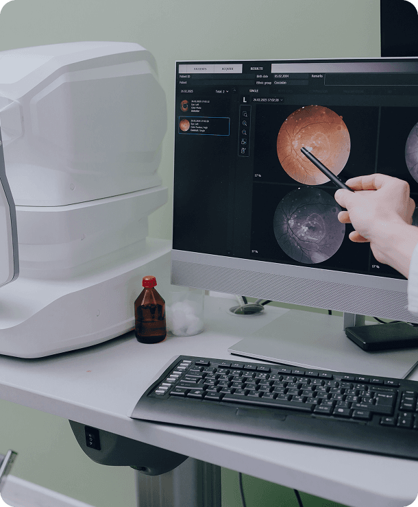 How do we diagnose AMD?